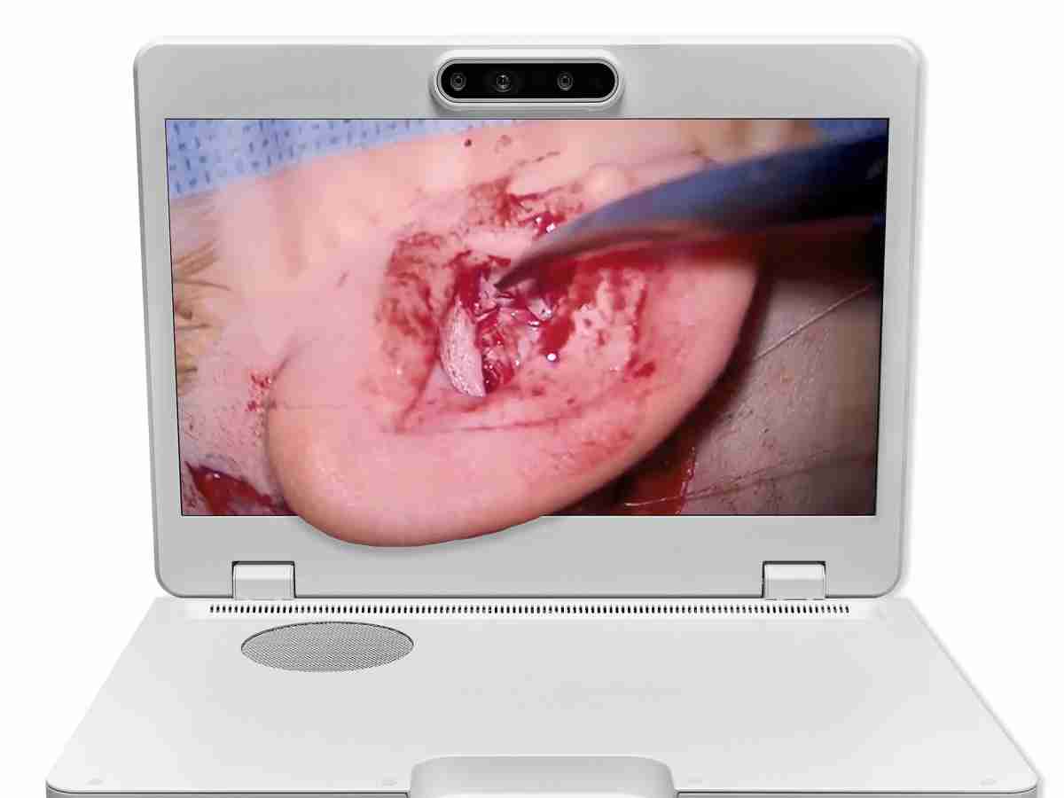 达擎之＂Heads-up 3D显微手术显示系统＂，，，，整合4K裸眼3D显示及眼球追踪系统，，，，具备快速追踪人眼移动位置功能，，减轻医师长时间维持固定姿势的负担，，让医师能有更宽广清晰的3D立体视野及更舒适的姿势来执行手术。。